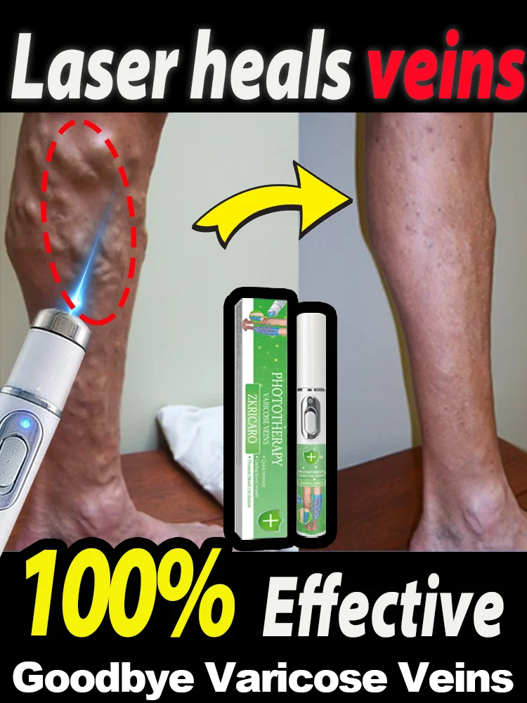 Синий лазер лечит варикозное расширение вен на ногах