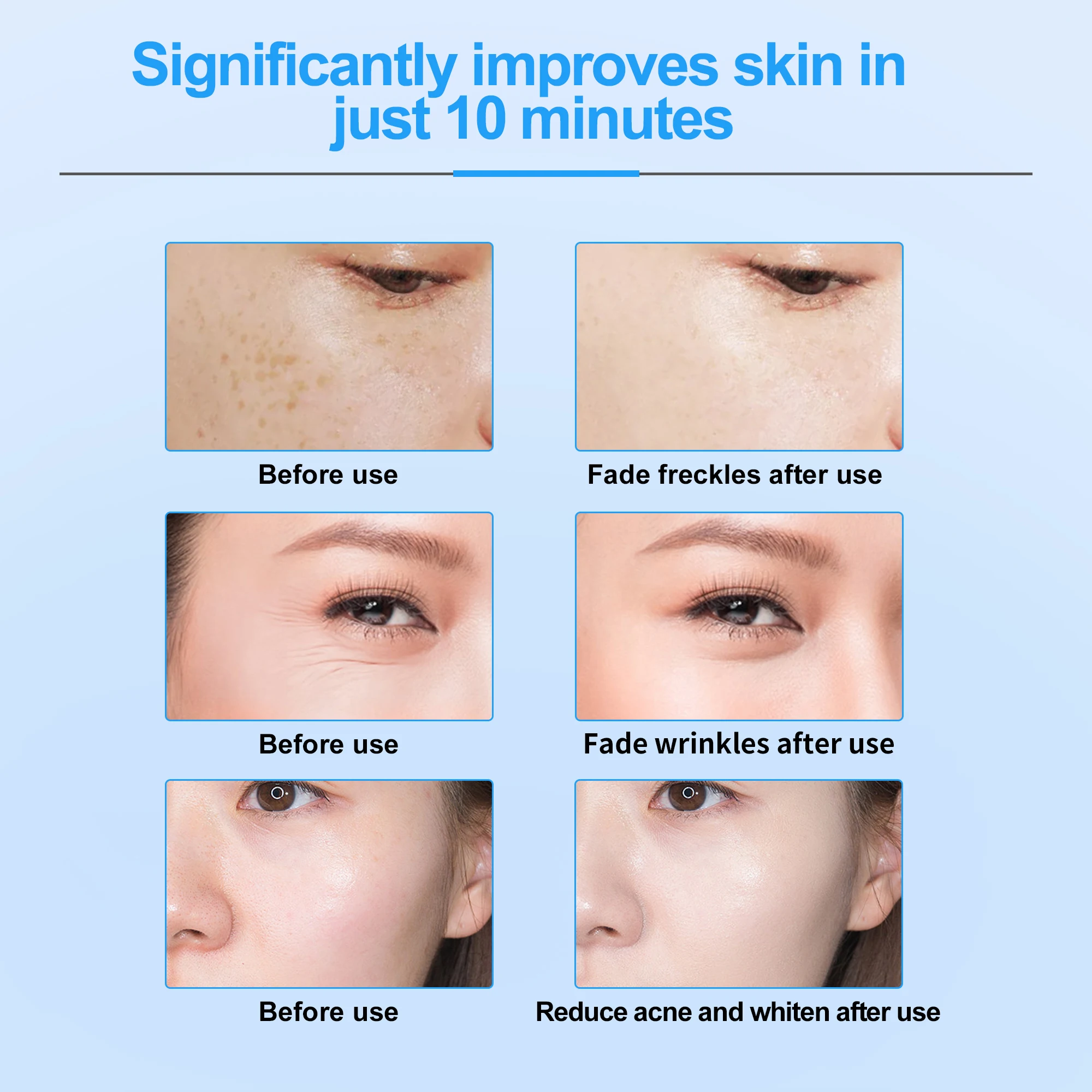 Мини-радиочастотный инструмент Beemyi для красоты омоложения и подтяжки кожи