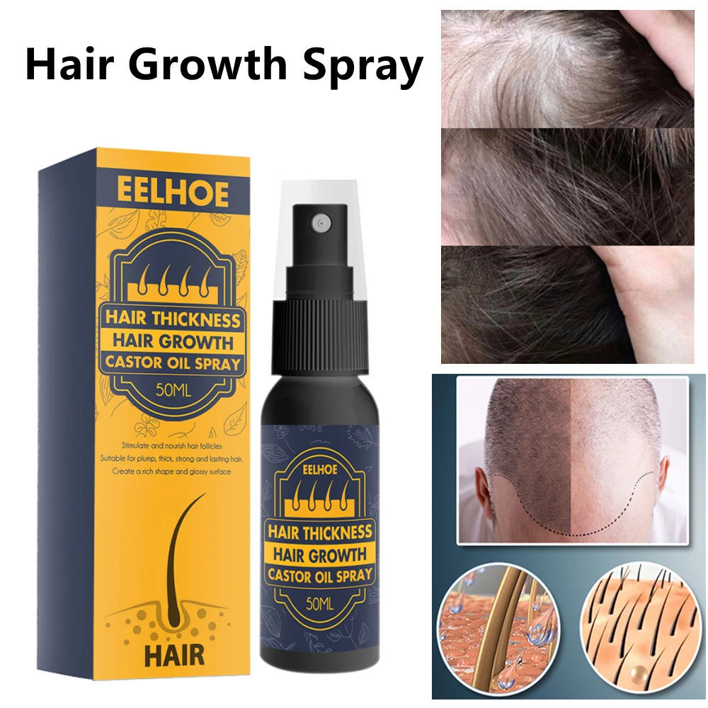 

50ml Castor Oil Hair Growth Spray Fast Growing Hair Essential Oil Hair Scalpel Care Prevent Hair Loss Oil Scalp Treatment Serum