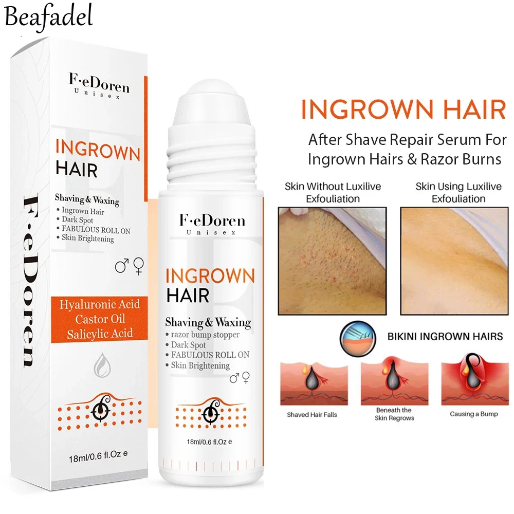 

Ingrowns Hair treatment Razor Bumps Removal Solution After Shave Repair Dark Spot Reduce Redness Serum for vanish PFB Skin Care