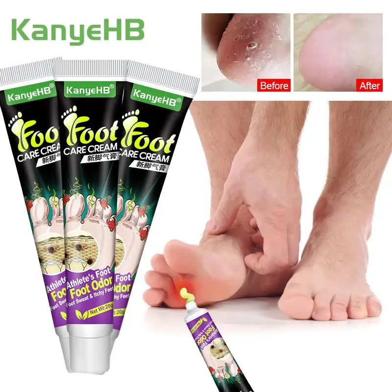 

1-3-5pc Tinea Pedis Treatment Cream Curing Beriberi Foot Odor Ulceration Inhibits Fungus Athlete's Foot Anti-itch Herb Ointment