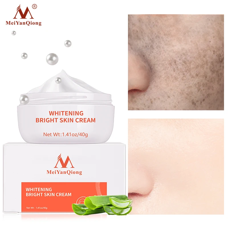 

40g Powerful Whitening Freckle Cream Remove Acne Spots Melanin Dark Spots Face Lift Firming Face Skin Care Beauty Essentials