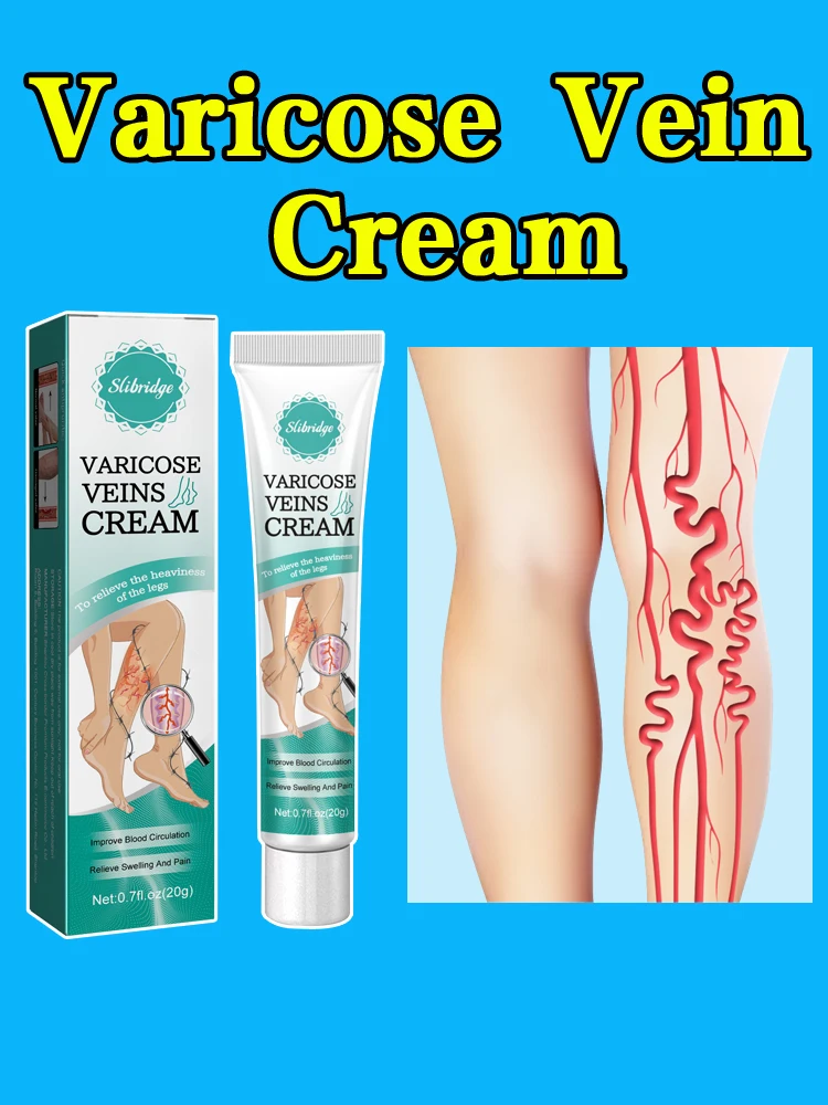 Помада для veias varicosas alivia Fiskmente как и vasculite flebite