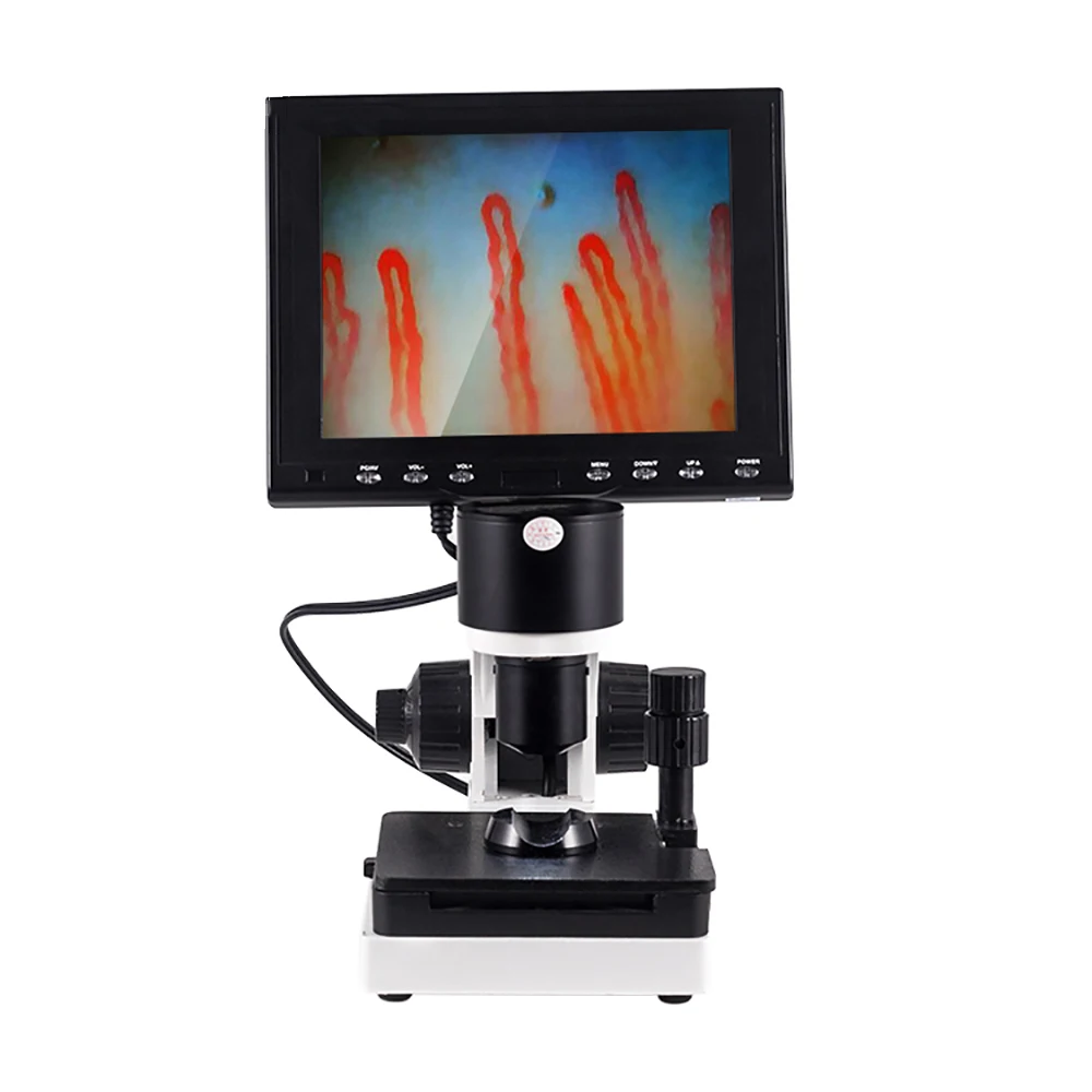 

Color LCD screen blood vessel microscope to diagnostic microcirculation