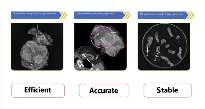 Устройство для груди EnCor Enspire Core с вакуумными иглами 7G использования в больнице