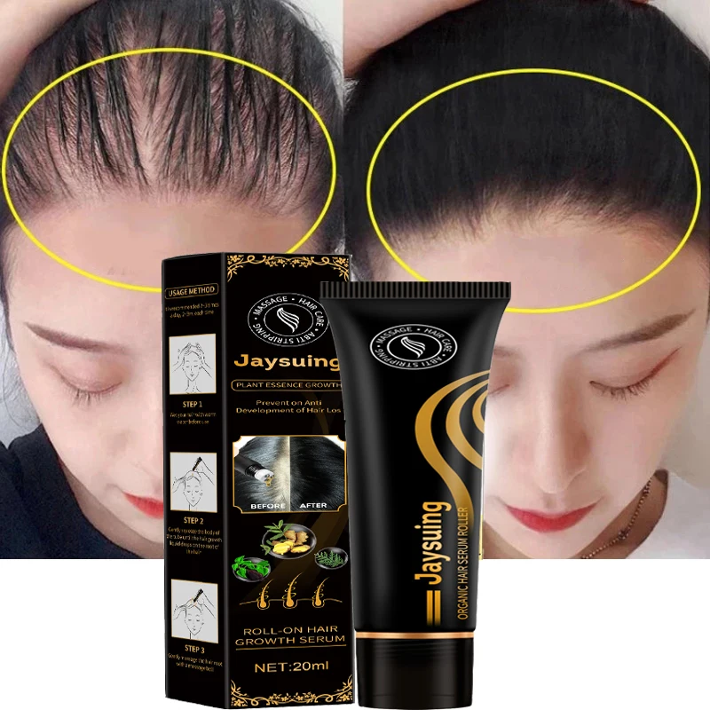 

Sdotter Hair Care Hair Growth Essential Oils Essence Original Authentic 100% Hair Loss Liquid Health Care Beauty Dense Hair Grow