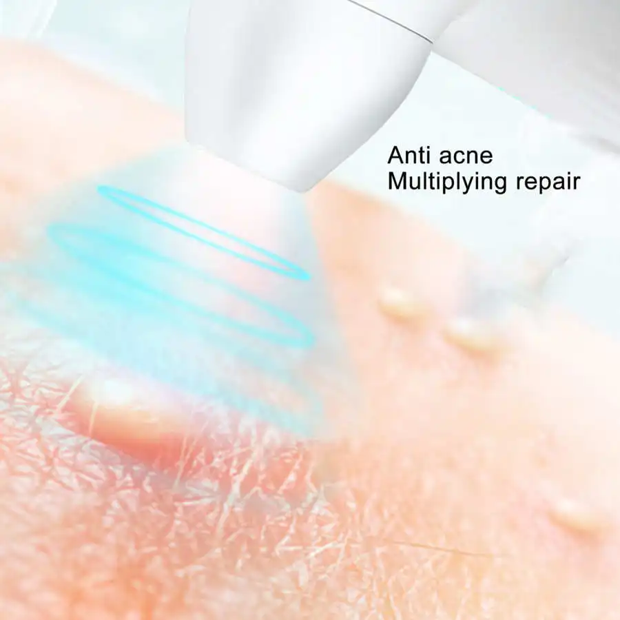 Пылесос для удаления черных точек инструмент терапии сисветильник салона