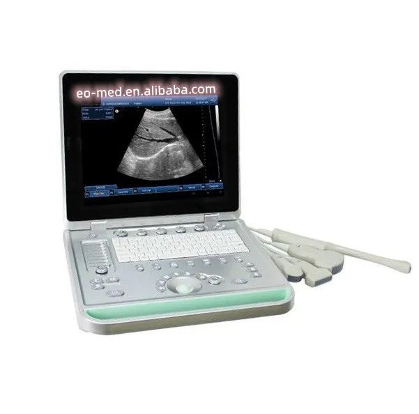 

Full digital Cheap price Portable B/W ultrasound machine transducer cheaper laptop ultrasonic scanner BW09