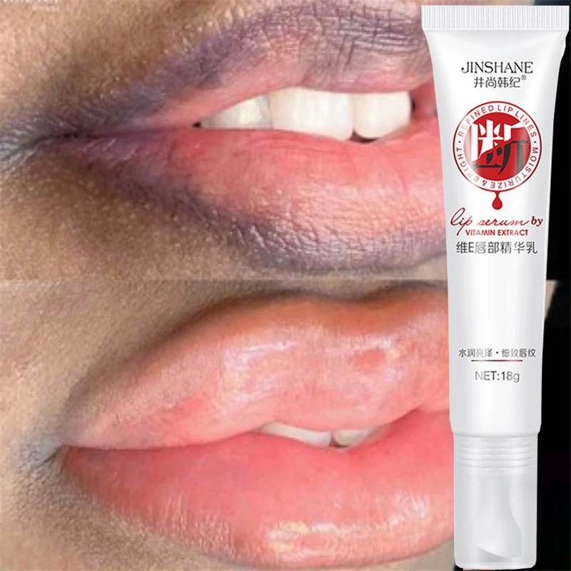 

Black Remove Lips Balm Lighten Dark Smoke Lip Whitening Fade Fine Lines Moisturizing Nourish Repair Dry Dull Lips Care Products