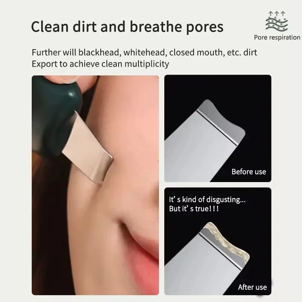 Портативная лопатка для угрей мини-устройство красоты ручная очищения лица