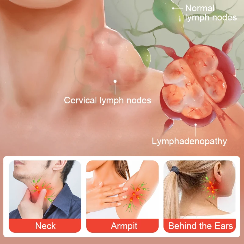 6 шт./1 упаковка травяные Пластыри для лимфатического дренажа