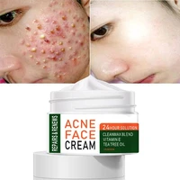 2022 best organic whitening herbal tea tree oil acne spot treatment removing anti acne face cream