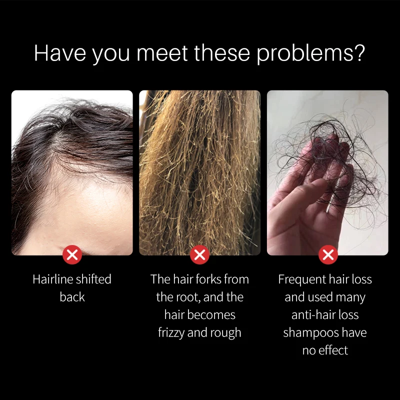 Масло для роста семян черного риса эфирное масло защиты от выпадения волос сухой