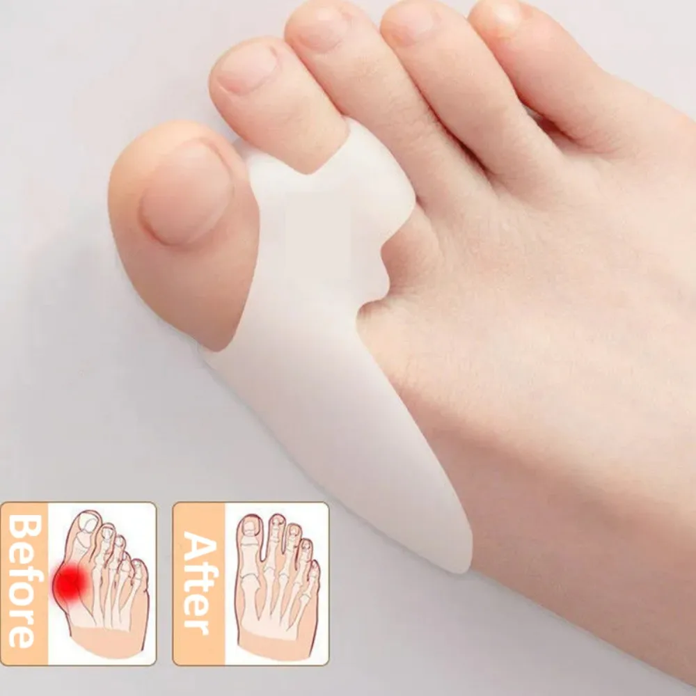 

2pcs Silicone Gel Thumb Corrector Bunion Foot Toe Hallux Valgus Protector Separator Finger Straightener Adjuster Foot Care Tool