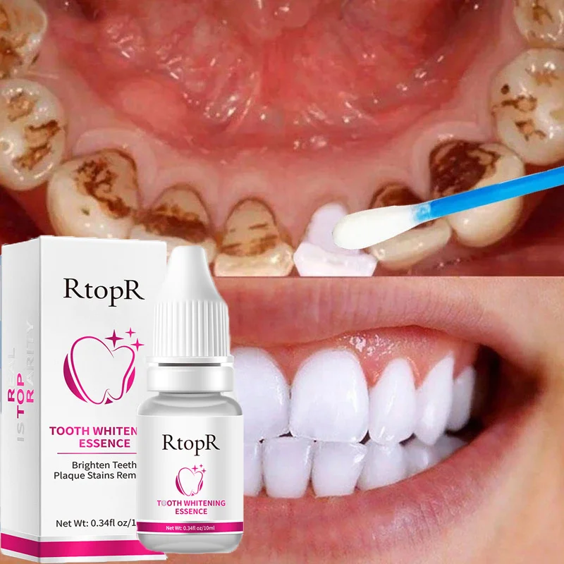 Teeth Whitening Serum Removal Stain Plaque Yellow Teeth Bleach Essence Deep Cleaning Fresh Breath Oral Hygiene Care Dental Tools