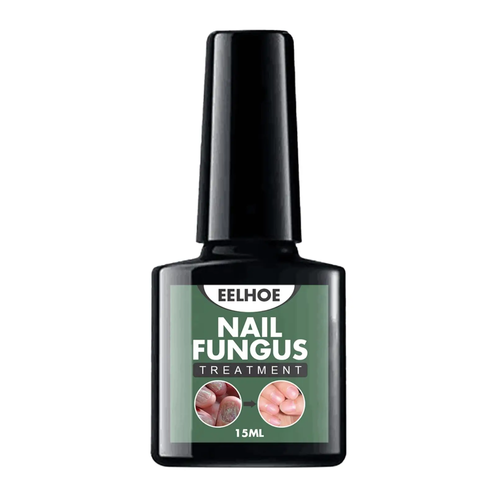 

Лечение грибка ногтей 15 мл восстанавливающая жидкость для ногтей растрескивание ногтей