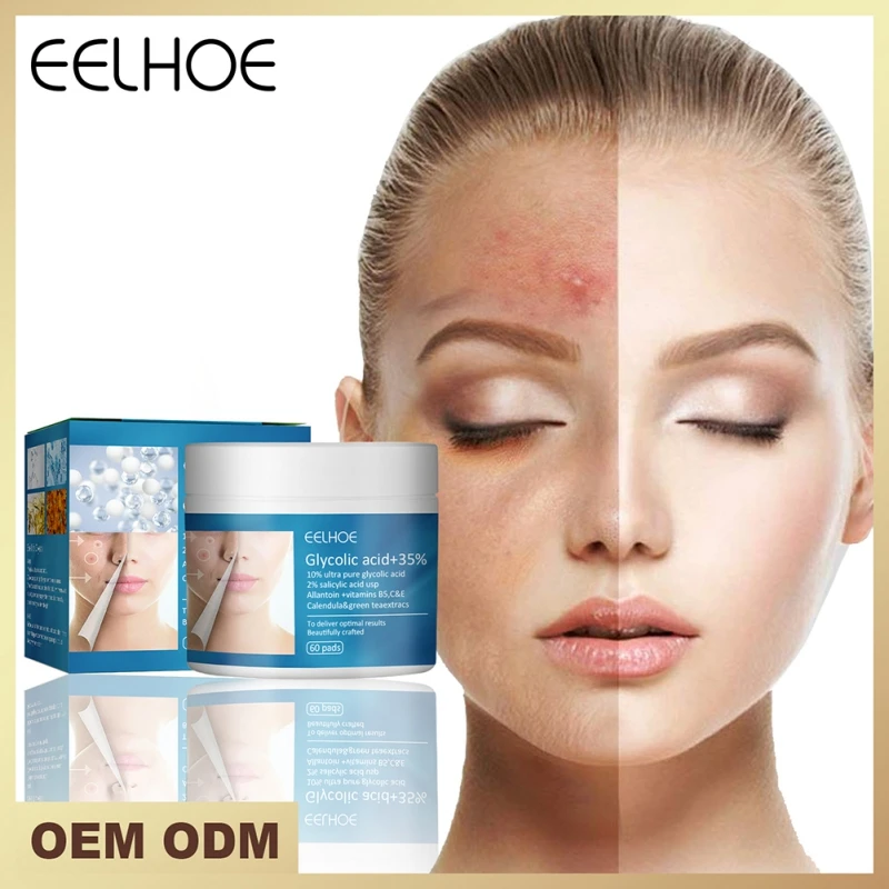 Подушечки для лечения акне и предотвращения жирных сочетаний прыщей на коже