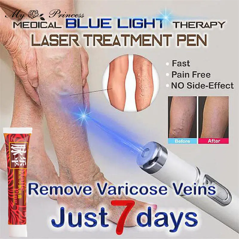 

1pc Medical Blue Light Therapy Laser Pen add 1Pc Varicose Veins Treatment Cream Soft Scar Wrinkle Removal Treatment Just 7 Days