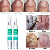 3ml nail nutrition pen antifungal nail repair solution bright nail bio protective film nail care pen