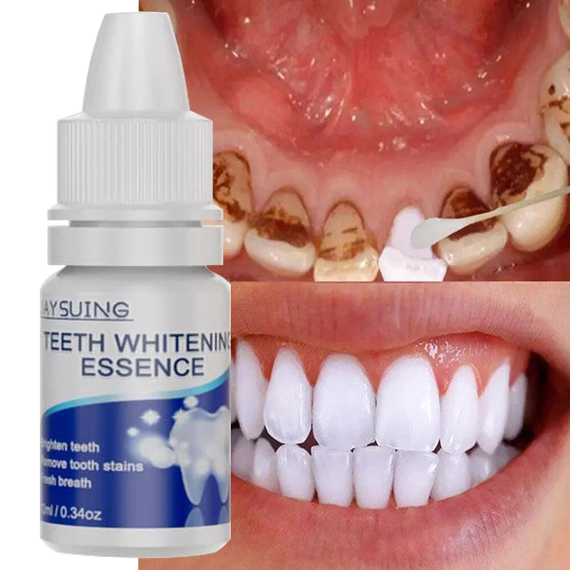 Teeth Whitening Serum Liqud Cleansing Oral Hygiene Products Essence Remove Yellow Teeth Coffee Plaque Stains Tools Dental Bleach