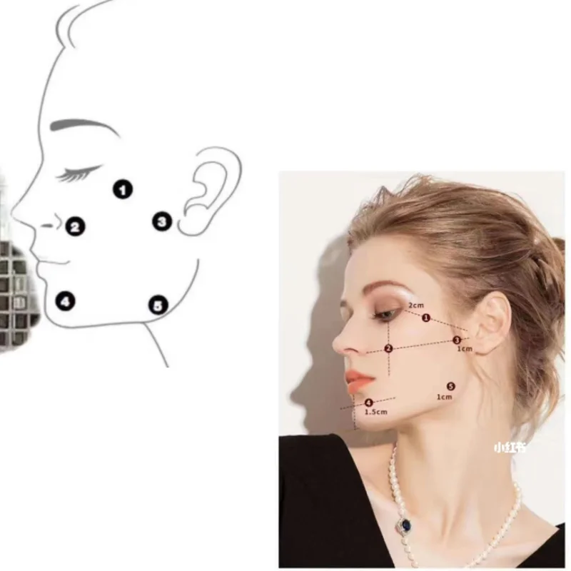 Рисунок 2 - Five point lifting 2ml good Измеритель