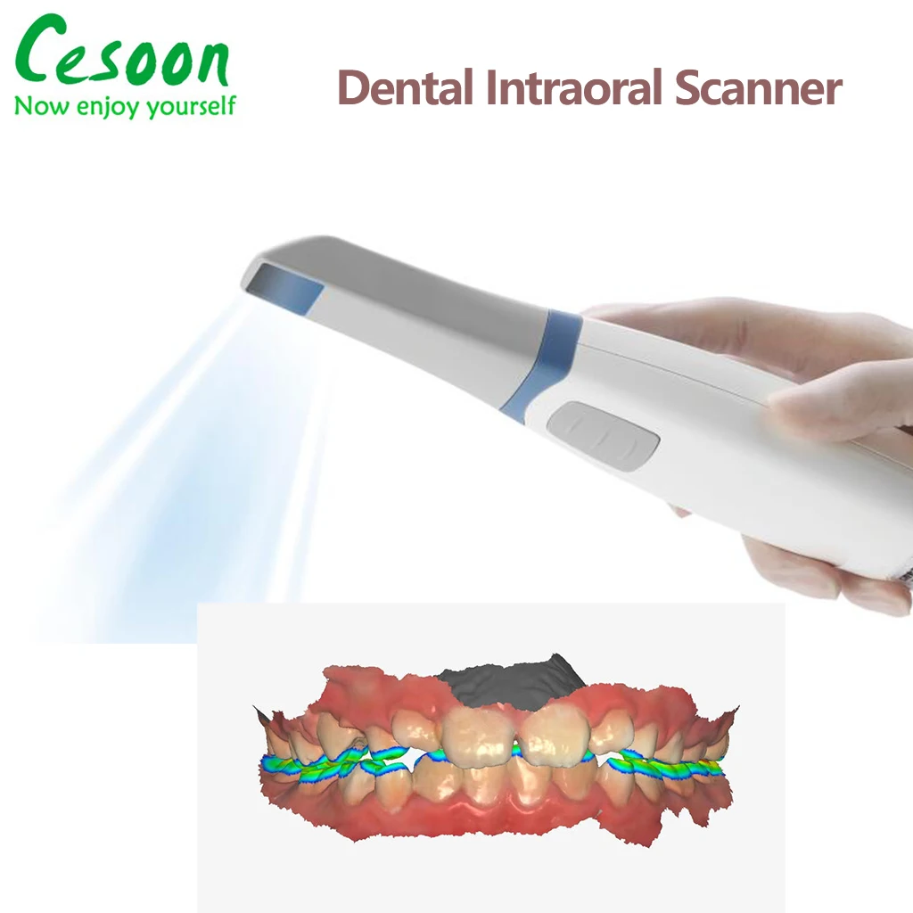 Новый 3D интраоральный цветной