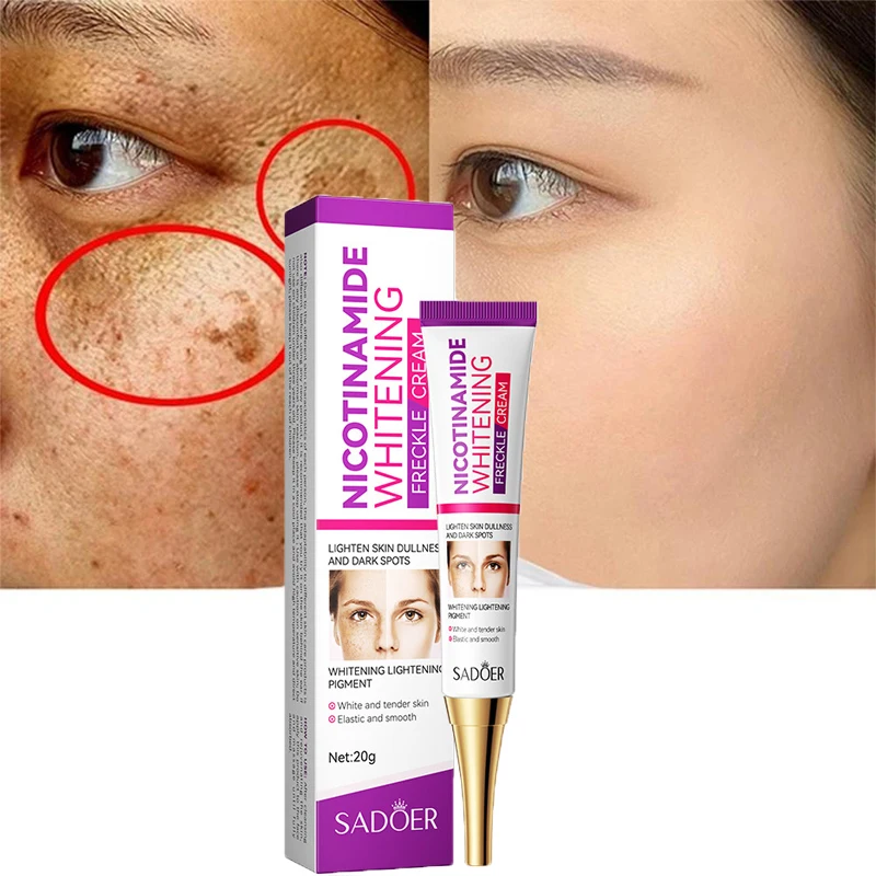 Whitening Freckle Cream Remove Dark Spots Melanin Melasma  Acne Spot Pigment Moisturizing Anti-Aging Brighten Skin Care Products