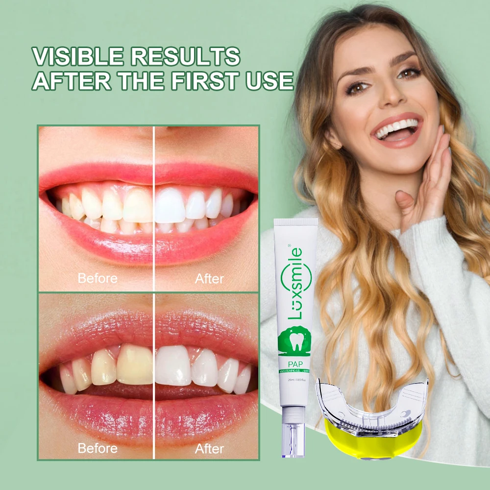 Luxsmile Teeth Whitening Kit Non Peroxide Gel Bleach Tooth Led Uv Light Set Laser Whitener Teeth Dental Whitening Free Shipping