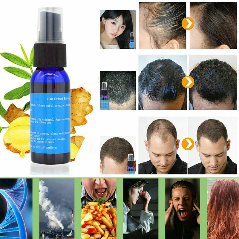 

Жидкий спрей против выпадения волос, эфирное масло для восстановления и увлажнения волос, 30 мл