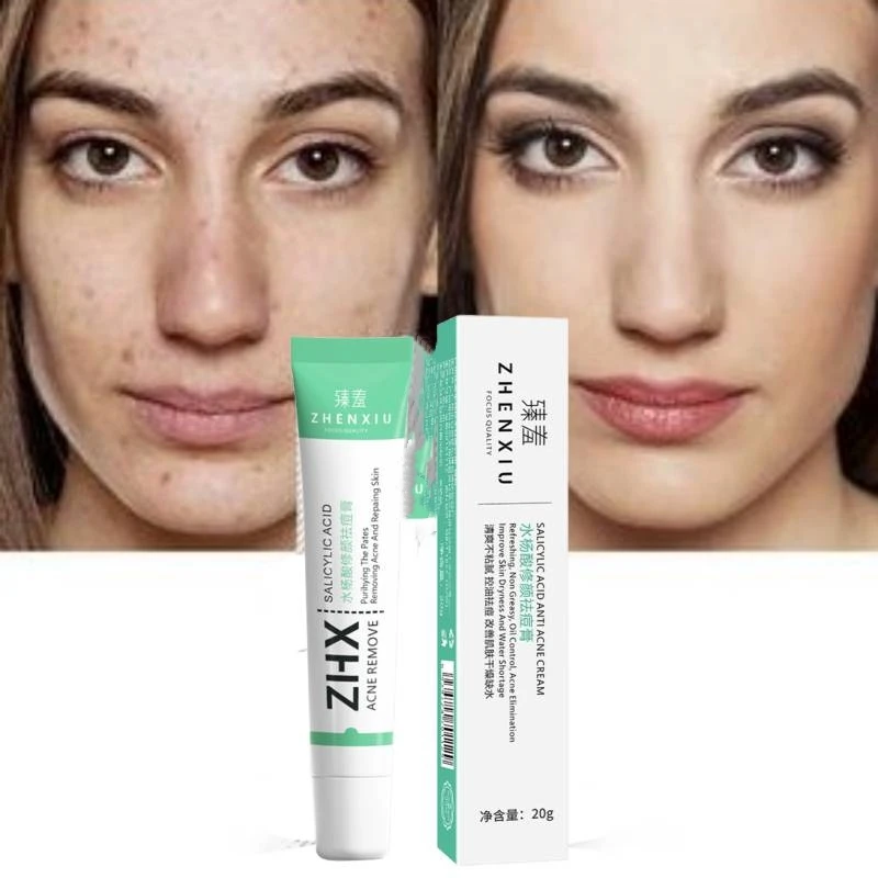 

Fade Spot Scar Fading Fast-acting Premium Powerful Visible Results Non-irritating Formula Natural Acne Treatment Acne Skin Care