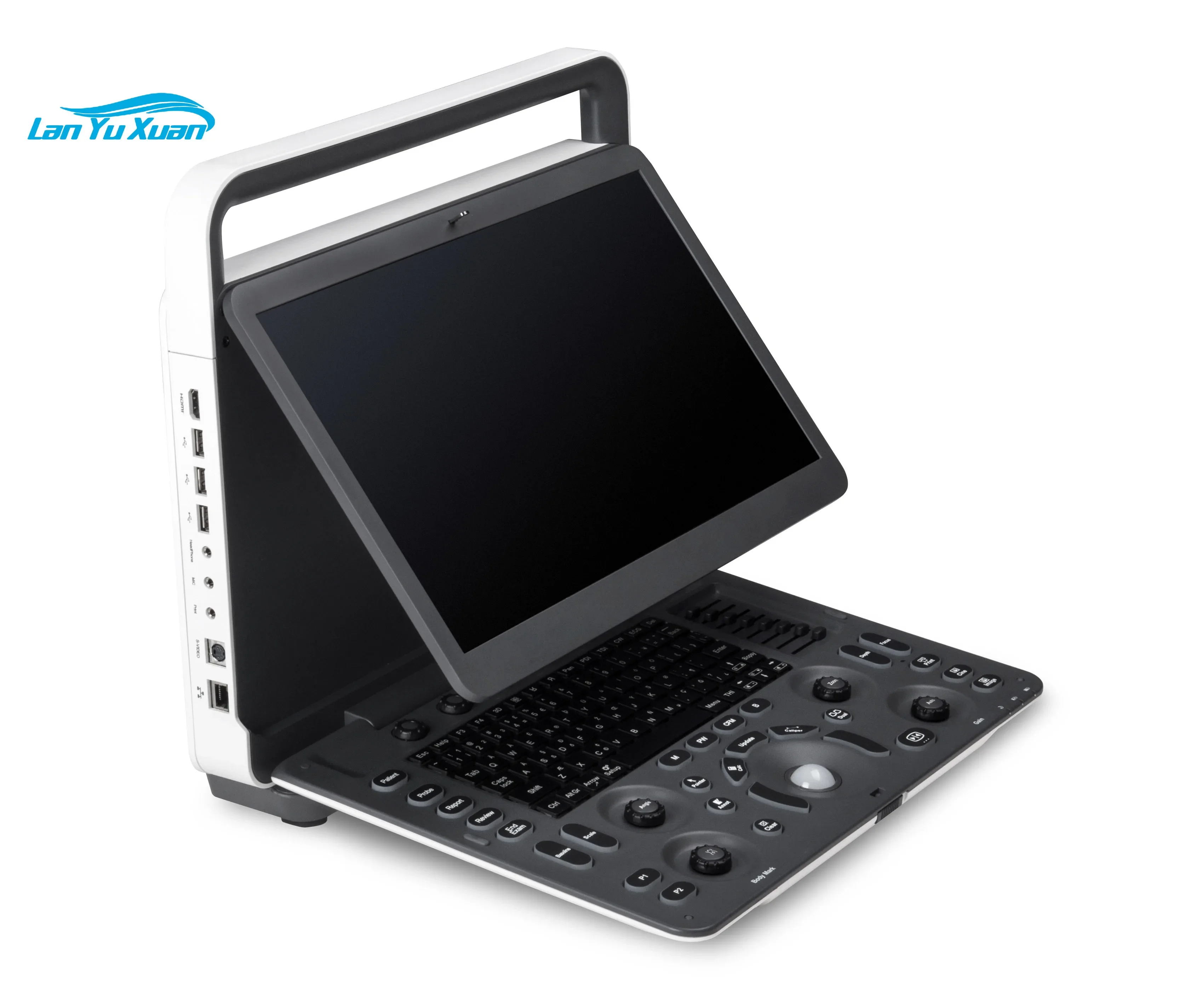 Рисунок 2 - Портативный цифровой цветной допплер