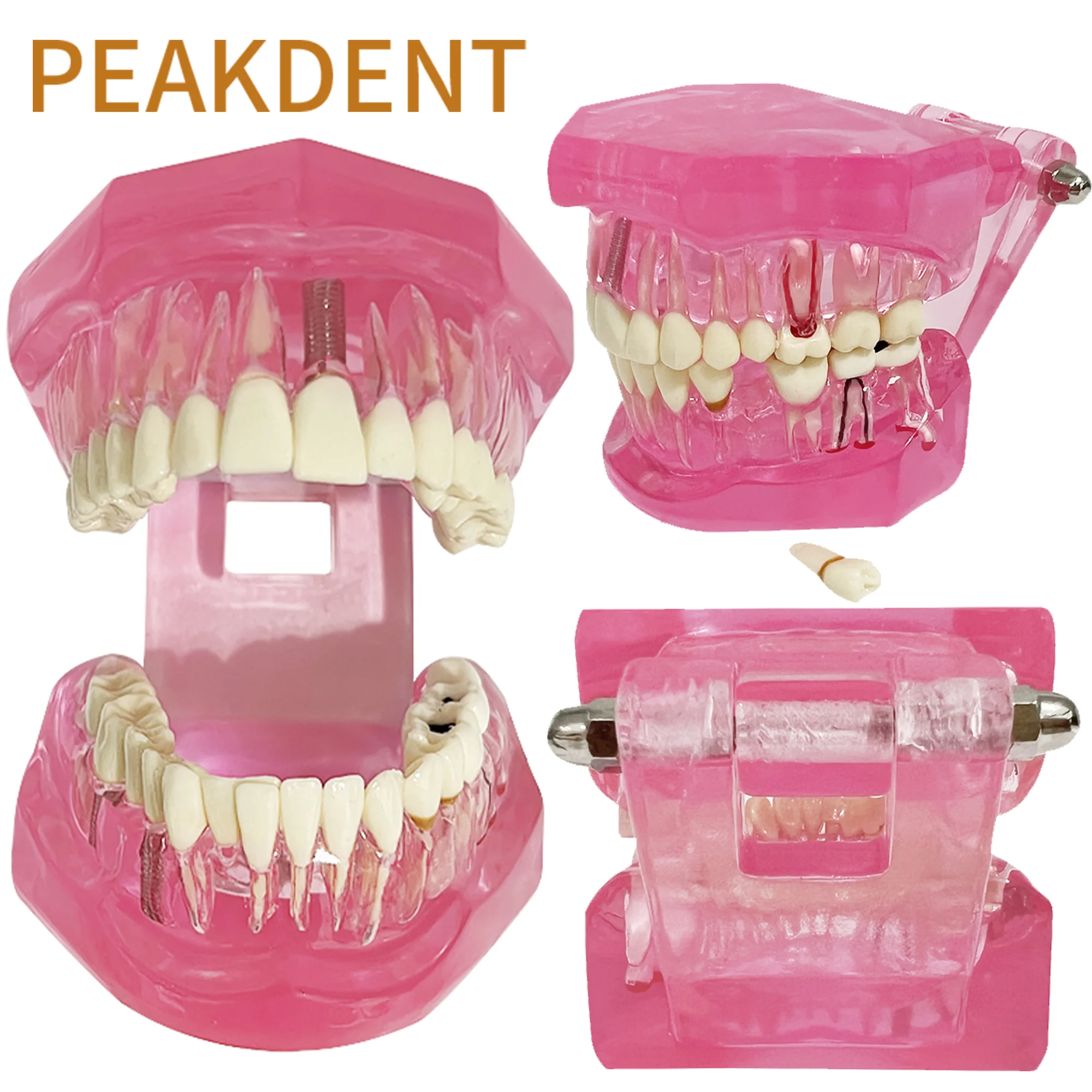 Модели зубов ремонтные модели из смолы для изучения и исследования медицины