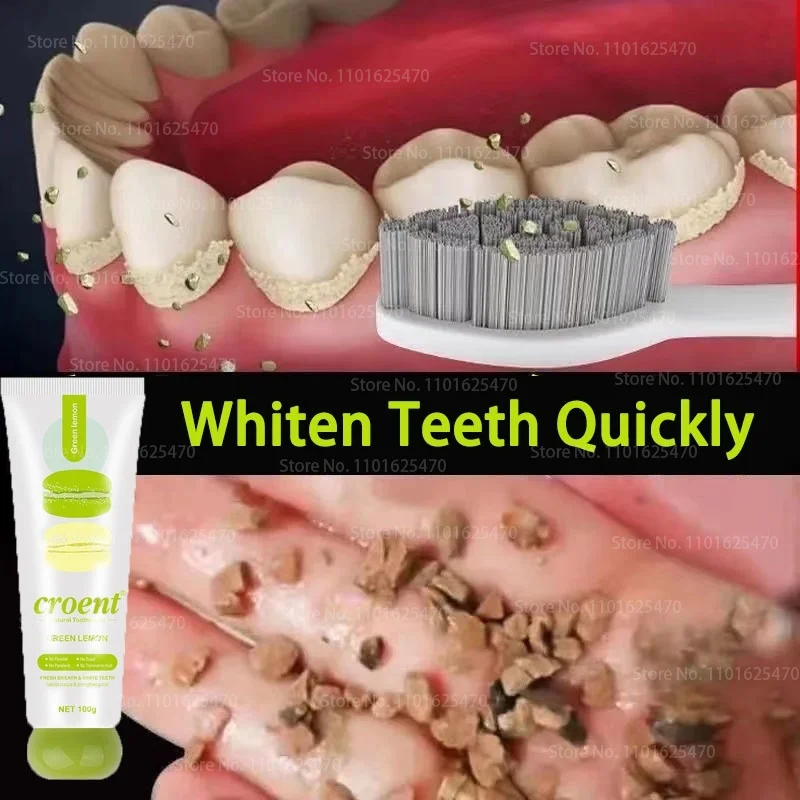 

Toothpaste Teeth Whitening Stain Remove Tartar Yellow Tartar Stone Plaque Anti Decay Freshener Tooth Cleaning Care Toothpaste