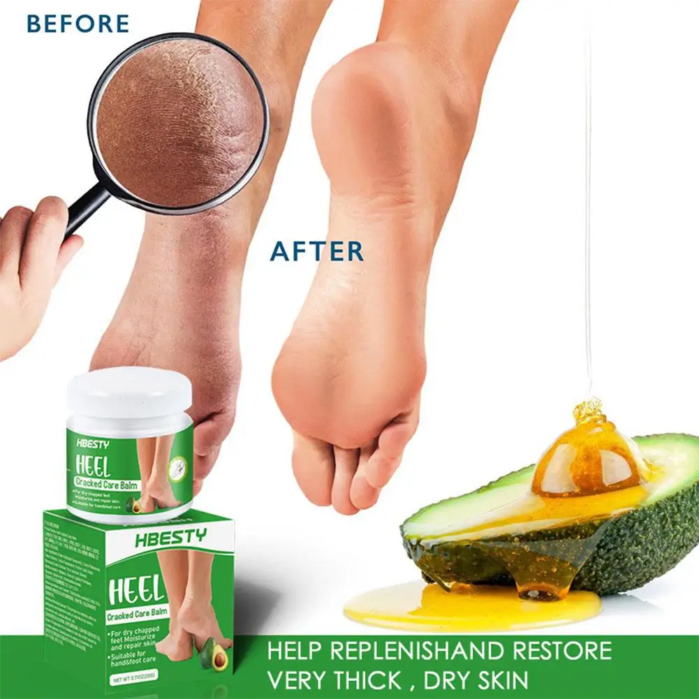 

20g Anti-Drying Crack Foot Cream Heel Cracked Repair Care And Removal Hand Hand Skin Skin Cream Feet Dead Foot Care P5Q4