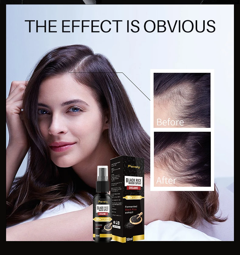 Black rice hair growth spray repair damage to restore all hair soft hair rapid treatment to prevent hair thinning and dry repair