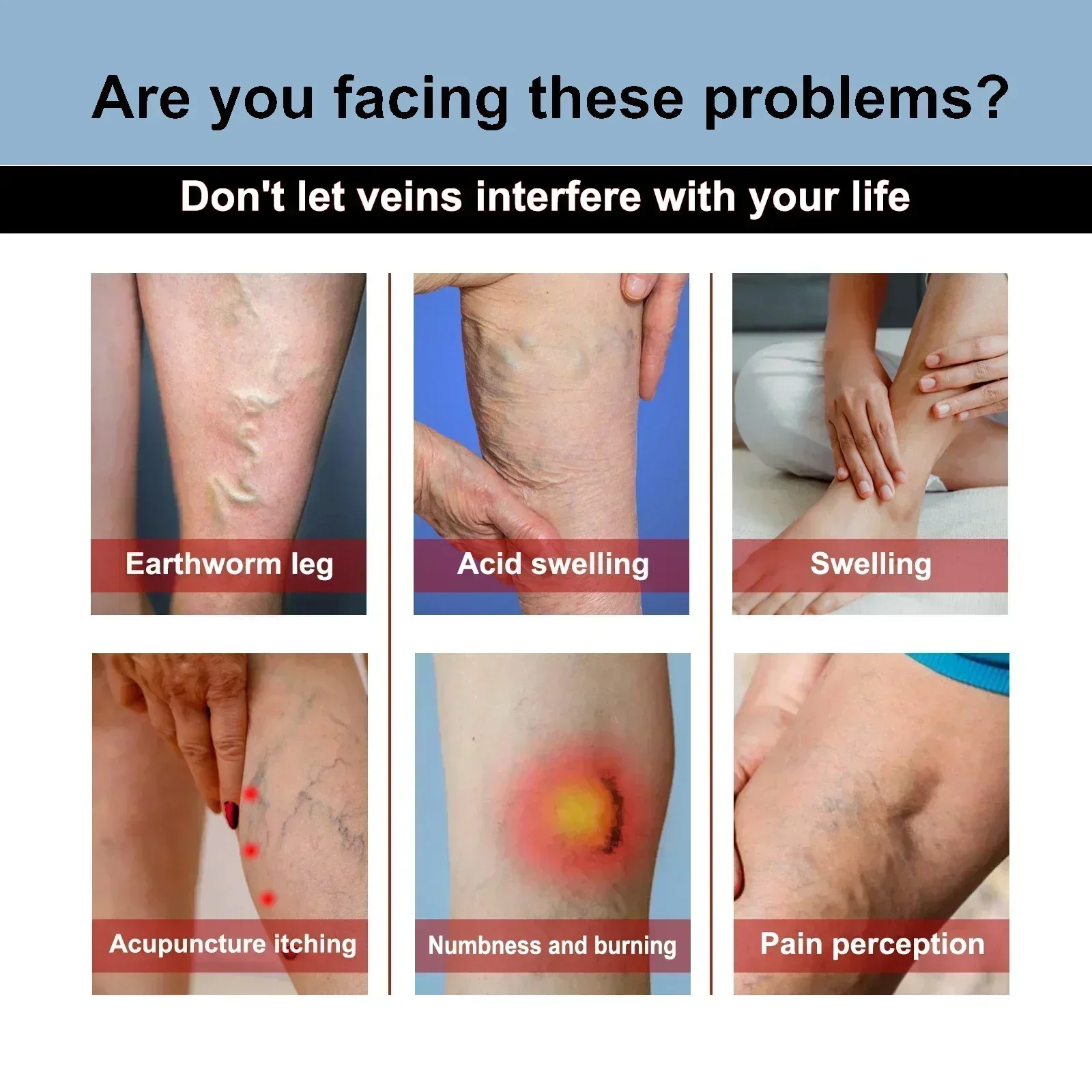 Инт для варикозного расширения вен васкулит флебит паук удаление ангиита из трав