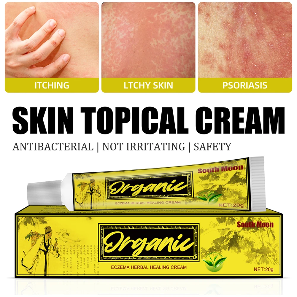 

20g Skin Psoriasis Cream Dermatitis Eczematoid Eczema Natural Herbal Ointment Treatment Psoriasis Relieve Various Skin Problem