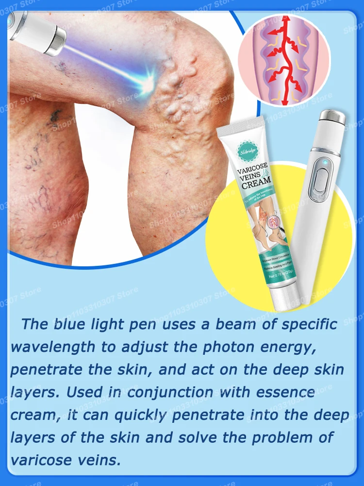 Ручка Varicosse Blu-ray Skin Cream