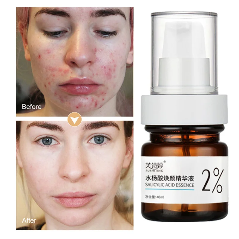 

Salicylic Acid 2% Solution Serum Remover Acne Repair Pimple Acne Scar Shrink Pores Oil-Control Whitening Korean Face Skin Care