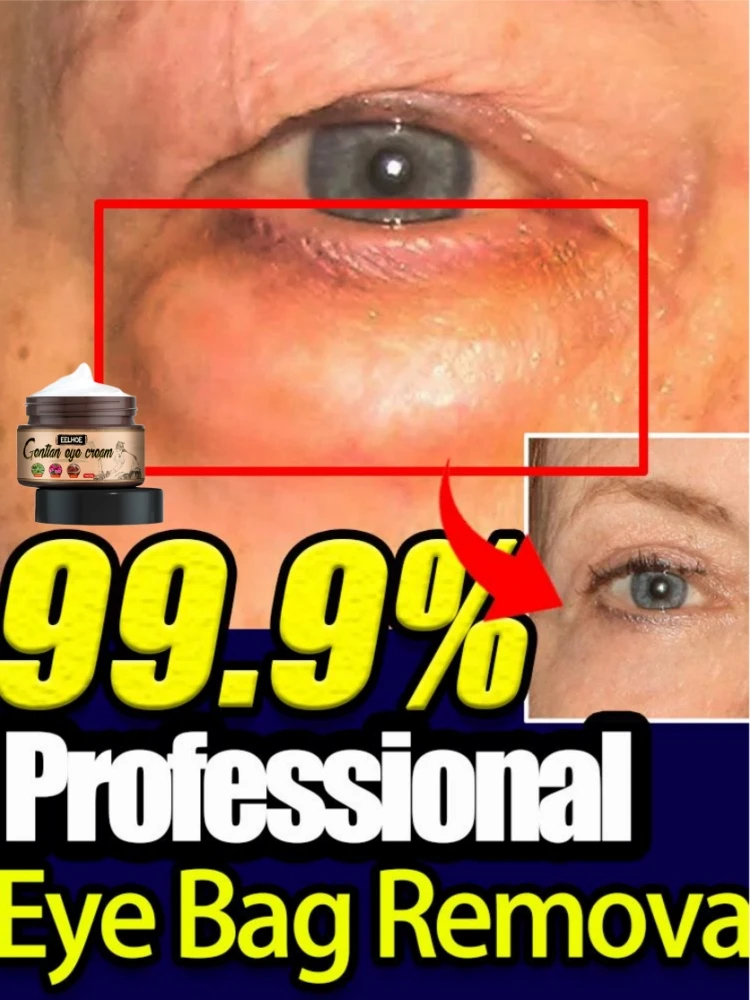 Быстрое удаление жира в гранулах