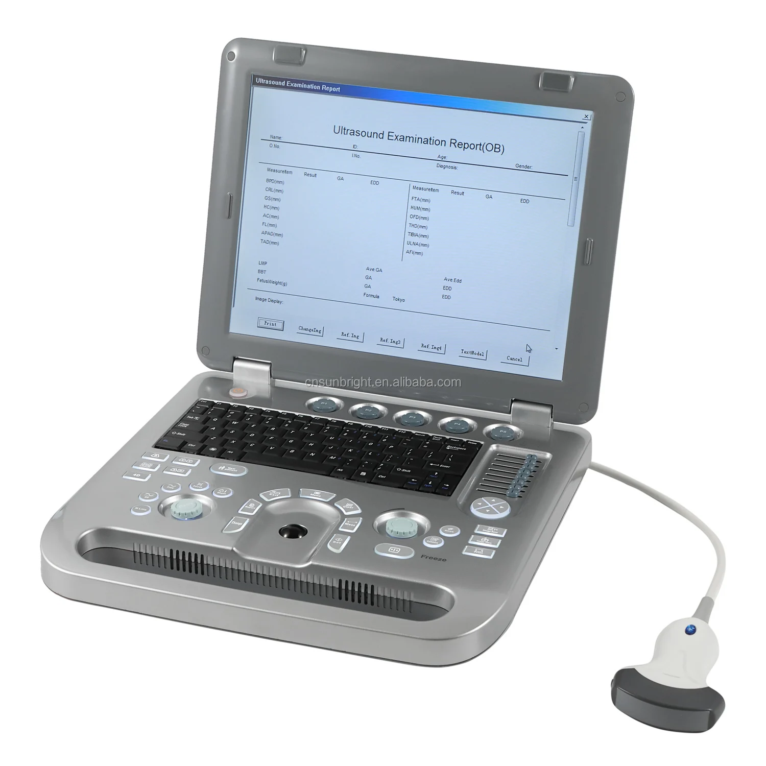 

Animal ultrasound diagnose scanner portable vet digital canine ultrasound machine