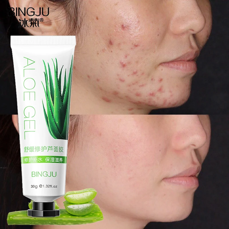 

Натуральный Растительный гель с алоэ вера увлажняющий Восстанавливающий дневной крем лечение Увлажнение Отбеливание мягкий Успокаивающи...