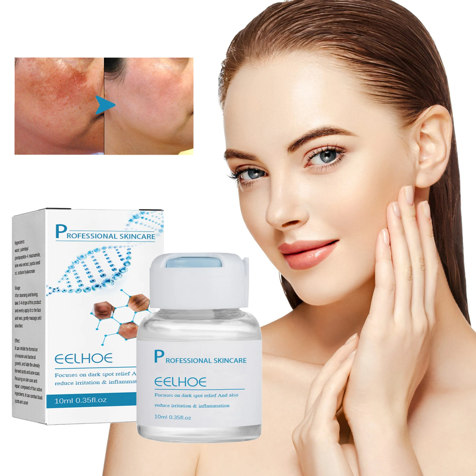 

Whitening Freckle Essence Anti-Aging Remove Dark Spots Chloasma Brightening Skin Tone Firming Sun Spots Pigment Melanin Serum
