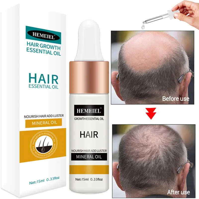 Эфирное масло для роста волос сыворотка быстро расти от потери уход поврежденных