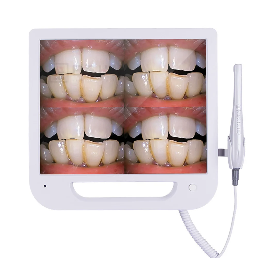 

Intraoral Camera Wifi HD 8 Million Pixels High-definition Endoscope Tools 17 Inches Digital LCD Monitor Dental Intraoral Tools