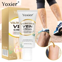 varicose vein repair cream pain relief improve dilated blood vessels in legs remove phlebitis spider veins relieve fatigue 50g