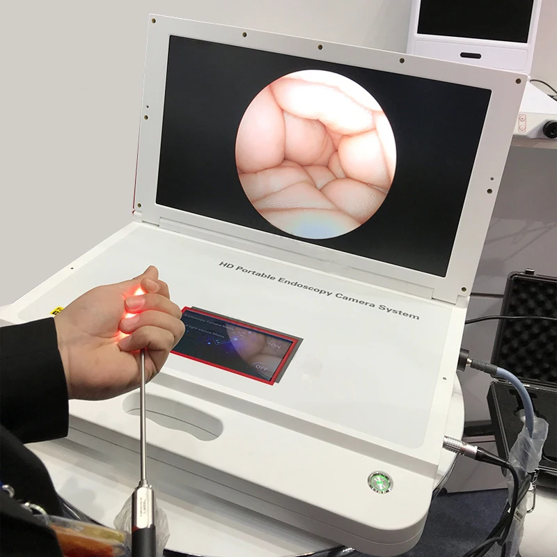 

Portable ent HD Medical endoscope system camera set for ENT/Urology/Arthroscope/Laparoscope