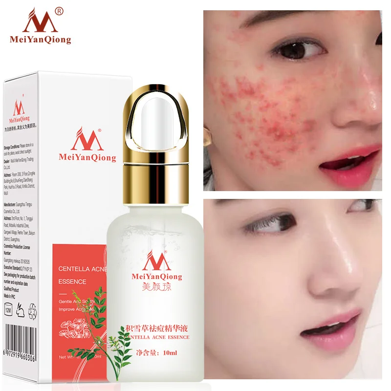 

Отбеливающий увлажняющий гель для лица, от прыщей и прыщей