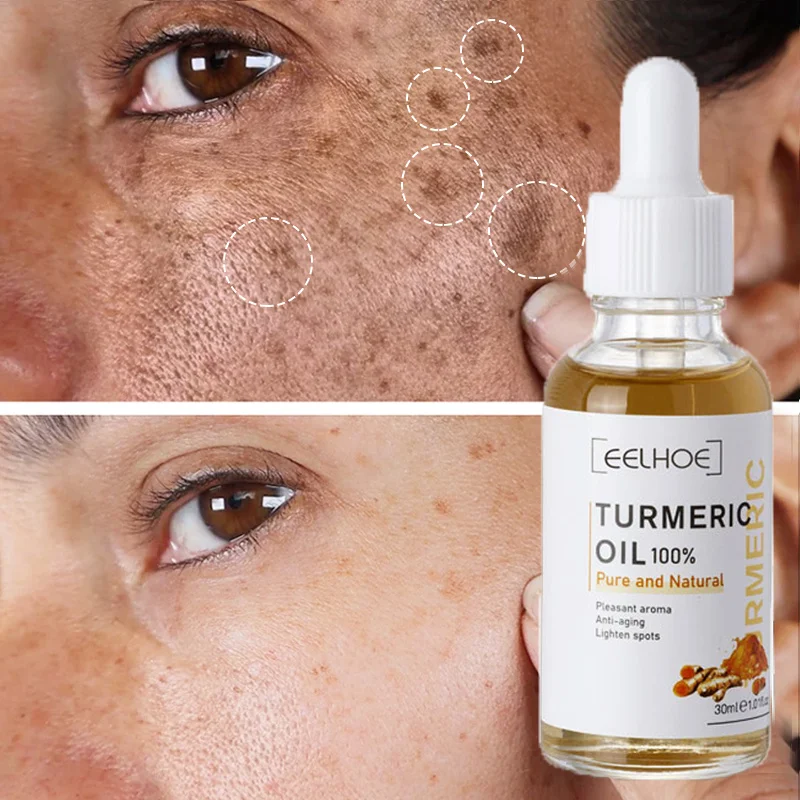 

Turmeric Whitening Freckles Serum Remove Dark Spots Melasma Brighten Lighten Melanin Improve Dull Anti-aging Face Skin Care
