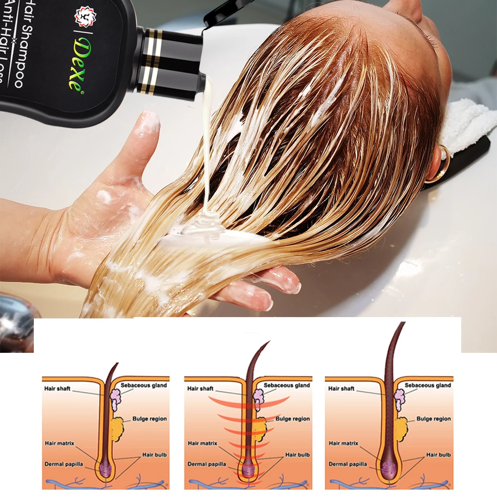 200ml Anti-hair Loss Shampoo Professional Chinese Herbal Growth Hair Treatment Hair Prevent Thick Hair Care Product for Adults